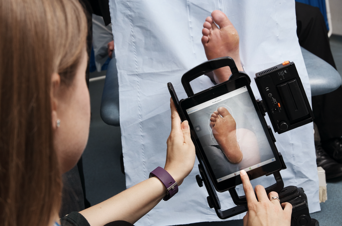 App launched to help monitor diabetic foot ulcers The Diabetes Times
